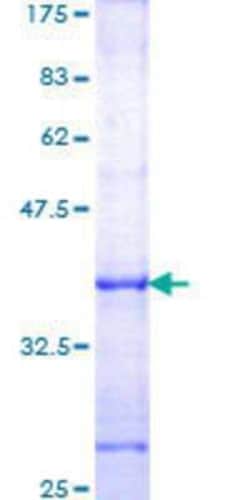 Novus Biologicals Recombinant Human DIRAS3 GST (N-Term) Protein 25 &mu;g | Buy Online | Novus Biologicals&trade; | Fisher Scientific