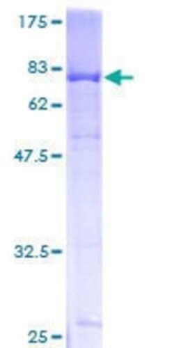 Novus Biologicals Recombinant Human LDB2 GST (N-Term) Protein 2 &mu;g | Buy Online | Novus Biologicals&trade; | Fisher Scientific