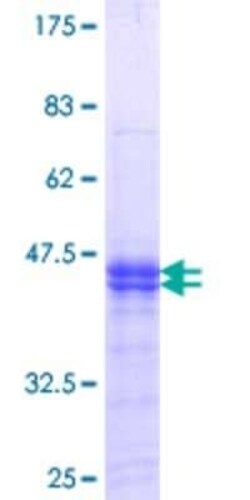 Novus Biologicals Recombinant Human PKMYT1 GST (N-Term) Protein 25 &mu;g | Buy Online | Novus Biologicals&trade; | Fisher Scientific