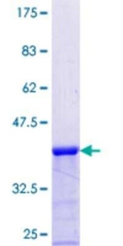 Novus Biologicals Recombinant Human PIGQ GST (N-Term) Protein 10 &mu;g | Buy Online | Novus Biologicals&trade; | Fisher Scientific