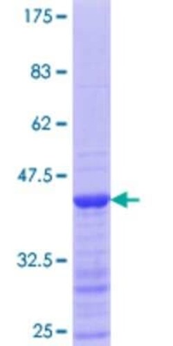 Novus Biologicals Recombinant Human SART1 GST (N-Term) Protein 10 &mu;g | Buy Online | Novus Biologicals&trade; | Fisher Scientific