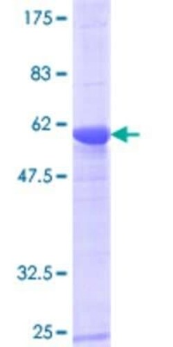 Novus Biologicals Recombinant Human UNC119 GST (N-Term) Protein 25 &mu;g | Buy Online | Novus Biologicals&trade; | Fisher Scientific