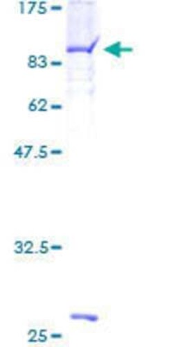 Novus Biologicals Recombinant Human MTMR6 GST (N-Term) Protein 2 &mu;g | Buy Online | Novus Biologicals&trade; | Fisher Scientific