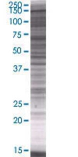 Novus Biologicals MTMR4 293T Cell Transient Overexpression Lysate 0,1 mL | Buy Online | Novus Biologicals&trade; | Fisher Scientific