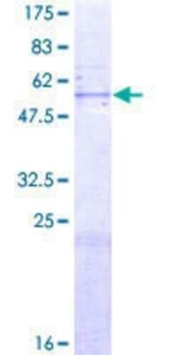 Novus Biologicals Recombinant Human MTA1 GST (N-Term) Protein 2 &mu;g | Buy Online | Novus Biologicals&trade; | Fisher Scientific