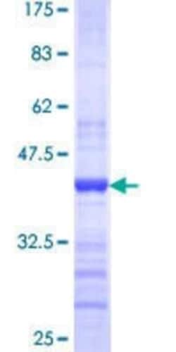 Novus Biologicals Recombinant Human MTA1 GST (N-Term) Protein 10 &mu;g | Buy Online | Novus Biologicals&trade; | Fisher Scientific