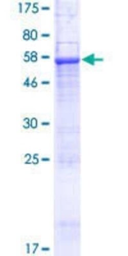 Novus Biologicals Recombinant Human SEC22C GST (N-Term) Protein 25 &mu;g | Buy Online | Novus Biologicals&trade; | Fisher Scientific
