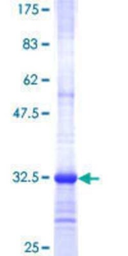 Novus Biologicals Recombinant Human SEC22C GST (N-Term) Protein 25 &mu;g | Buy Online | Novus Biologicals&trade; | Fisher Scientific
