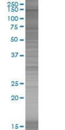 Novus Biologicals&trade;&nbsp;SMC3 293T Cell Transient Overexpression Lysate