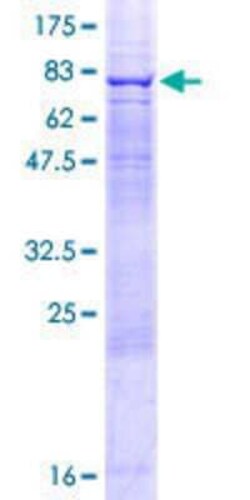 Novus Biologicals&trade;&nbsp;Recombinant Human PRPF4 GST (N-Term) Protein