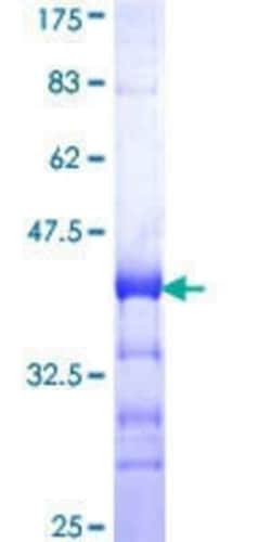 Novus Biologicals Recombinant Human PRPF3 GST (N-Term) Protein 25 &mu;g | Buy Online | Novus Biologicals&trade; | Fisher Scientific