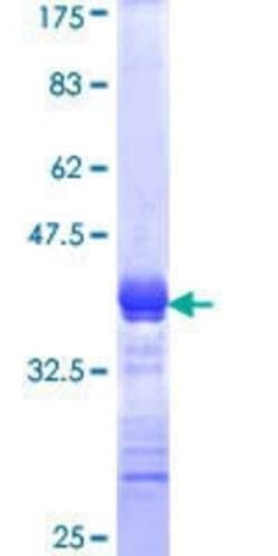 Novus Biologicals Recombinant Human Kv7.4 GST (N-Term) Protein 25 &mu;g | Buy Online | Novus Biologicals&trade; | Fisher Scientific