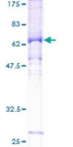Novus Biologicals Recombinant Human Cyclin E2 GST (N-Term) Protein 25 &mu;g | Buy Online | Novus Biologicals&trade; | Fisher Scientific