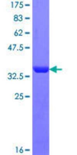 Novus Biologicals Recombinant Human RABEP1 GST (N-Term) Protein 25 &mu;g | Buy Online | Novus Biologicals&trade; | Fisher Scientific
