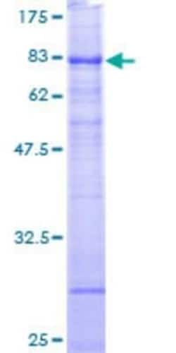 Novus Biologicals Recombinant Human RRP9 GST (N-Term) Protein 10 &mu;g | Buy Online | Novus Biologicals&trade; | Fisher Scientific