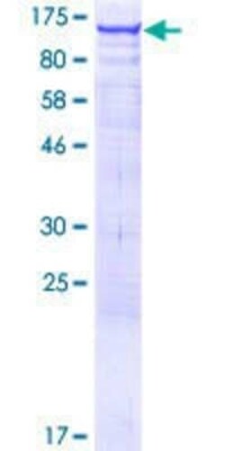 Novus Biologicals Recombinant Human ARHGEF1 GST (N-Term) Protein 25 &mu;g | Buy Online | Novus Biologicals&trade; | Fisher Scientific