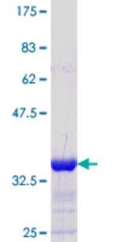 Novus Biologicals Recombinant Human MTGR1 GST (N-Term) Protein 10 &mu;g | Buy Online | Novus Biologicals&trade; | Fisher Scientific