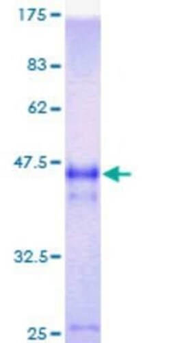 Novus Biologicals Recombinant Human ATG12 GST (N-Term) Protein 25 &mu;g | Buy Online | Novus Biologicals&trade; | Fisher Scientific