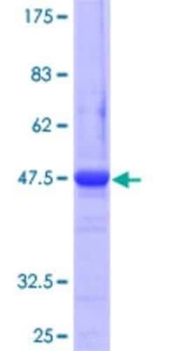 Novus Biologicals Recombinant Human ATG12 GST (N-Term) Protein 25 &mu;g | Buy Online | Novus Biologicals&trade; | Fisher Scientific