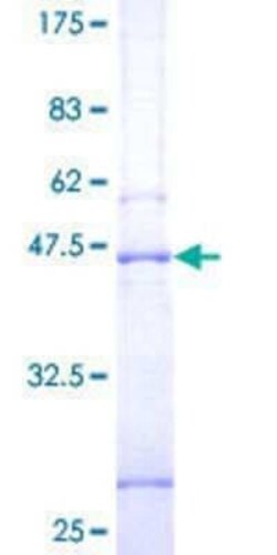 Novus Biologicals Recombinant Human Synaptogyrin 1 GST (N-Term) Protein 10 &mu;g | Buy Online | Novus Biologicals&trade; | Fisher Scientific