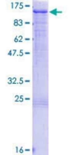 Novus Biologicals Recombinant Human HGS GST (N-Term) Protein 10 &mu;g | Buy Online | Novus Biologicals&trade; | Fisher Scientific