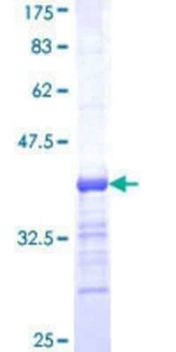 Novus Biologicals Recombinant Human HGS GST (N-Term) Protein 10 &mu;g | Buy Online | Novus Biologicals&trade; | Fisher Scientific