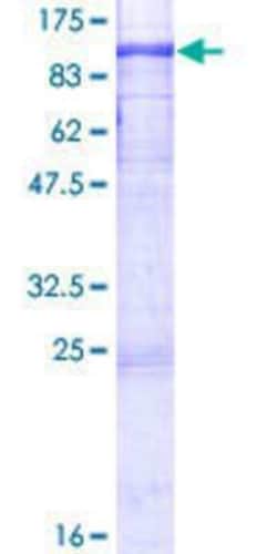 Novus Biologicals Recombinant Human Dyrk1B GST (N-Term) Protein 10 &mu;g | Buy Online | Novus Biologicals&trade; | Fisher Scientific