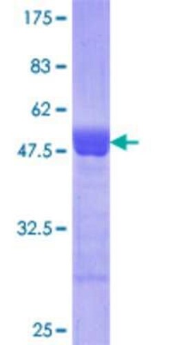 Novus Biologicals Recombinant Human FCP1 GST (N-Term) Protein 10 &mu;g | Buy Online | Novus Biologicals&trade; | Fisher Scientific