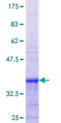 Novus Biologicals Recombinant Human SLC28A2 GST (N-Term) Protein 10 &mu;g | Buy Online | Novus Biologicals&trade; | Fisher Scientific