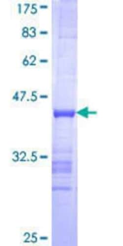 Novus Biologicals Recombinant Human Exonuclease 1 GST (N-Term) Protein 25 &mu;g | Buy Online | Novus Biologicals&trade; | Fisher Scientific