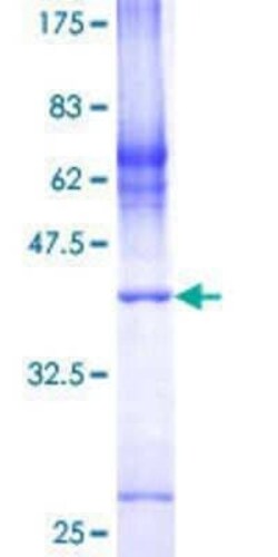 Novus Biologicals Recombinant Human COX7A2L GST (N-Term) Protein 25 &mu;g | Buy Online | Novus Biologicals&trade; | Fisher Scientific