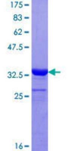 Novus Biologicals Recombinant Human COX7A2L GST (N-Term) Protein 25 &mu;g | Buy Online | Novus Biologicals&trade; | Fisher Scientific