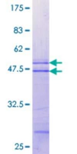 Novus Biologicals Recombinant Human MAP3K13 GST (N-Term) Protein 25 &mu;g | Buy Online | Novus Biologicals&trade; | Fisher Scientific