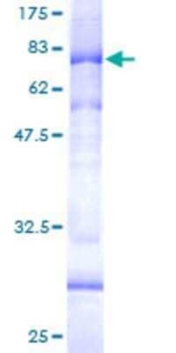 Novus Biologicals Recombinant Human AP4M1 GST (N-Term) Protein 25 &mu;g | Buy Online | Novus Biologicals&trade; | Fisher Scientific
