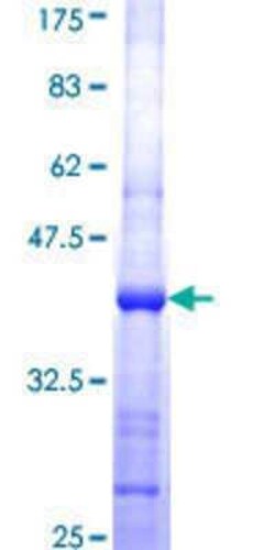 Novus Biologicals Recombinant Human AP4M1 GST (N-Term) Protein 10 &mu;g | Buy Online | Novus Biologicals&trade; | Fisher Scientific