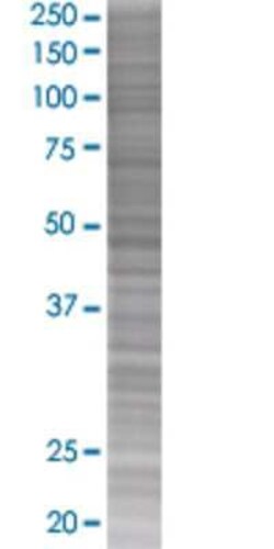 Novus Biologicals OSMR beta 293T Cell Transient Overexpression Lysate 0,1 mL | Buy Online | Novus Biologicals&trade; | Fisher Scientific
