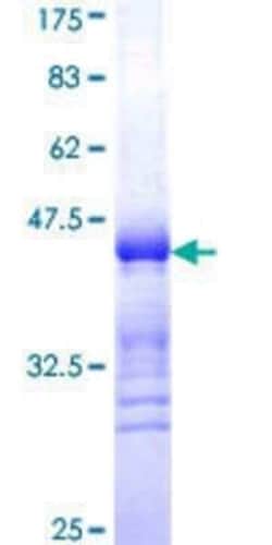 Novus Biologicals Recombinant Human GEF-H1 GST (N-Term) Protein 10 &mu;g | Buy Online | Novus Biologicals&trade; | Fisher Scientific