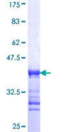 Novus Biologicals Recombinant Human REPS2 GST (N-Term) Protein 10 &mu;g | Buy Online | Novus Biologicals&trade; | Fisher Scientific