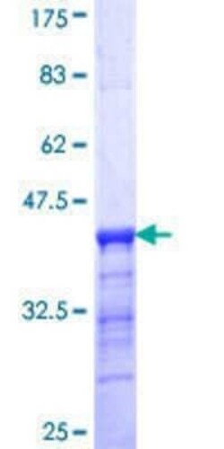 Novus Biologicals Recombinant Human SLC24A1 GST (N-Term) Protein 25 &mu;g | Buy Online | Novus Biologicals&trade; | Fisher Scientific