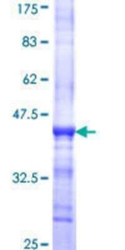 Novus Biologicals Recombinant Human DCLK1 GST (N-Term) Protein 25 &mu;g | Buy Online | Novus Biologicals&trade; | Fisher Scientific