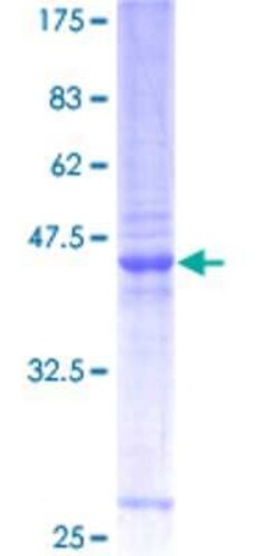 Novus Biologicals Recombinant Human ZMYM6 GST (N-Term) Protein 2 &mu;g | Buy Online | Novus Biologicals&trade; | Fisher Scientific