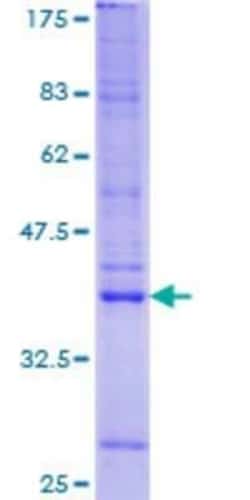 Novus Biologicals Recombinant Human LRRFIP1 GST (N-Term) Protein 25 &mu;g | Buy Online | Novus Biologicals&trade; | Fisher Scientific