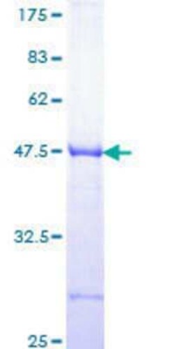 Novus Biologicals&trade;&nbsp;Recombinant Human LRRFIP1 GST (N-Term) Protein