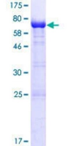 Novus Biologicals Recombinant Human LRRFIP2 GST (N-Term) Protein 10 &mu;g | Buy Online | Novus Biologicals&trade; | Fisher Scientific