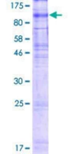 Novus Biologicals Recombinant Human XPR1 GST (N-Term) Protein 2 &mu;g | Buy Online | Novus Biologicals&trade; | Fisher Scientific
