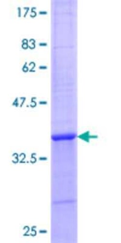 Novus Biologicals Recombinant Human XPR1 GST (N-Term) Protein 10 &mu;g | Buy Online | Novus Biologicals&trade; | Fisher Scientific