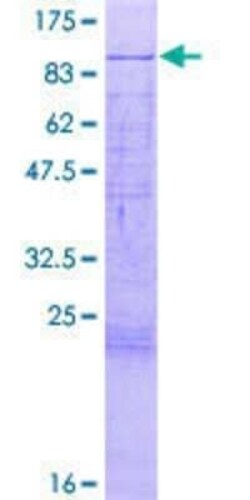 Novus Biologicals Recombinant Human MTA2 GST (N-Term) Protein 2 &mu;g | Buy Online | Novus Biologicals&trade; | Fisher Scientific