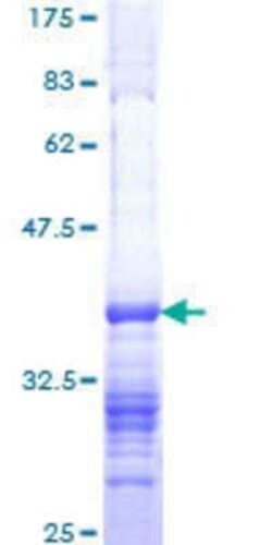 Novus Biologicals Recombinant Human MTA2 GST (N-Term) Protein 25 &mu;g | Buy Online | Novus Biologicals&trade; | Fisher Scientific