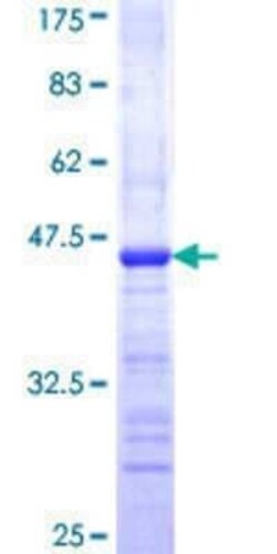 Novus Biologicals Recombinant Human MAGI1 GST (N-Term) Protein 25 &mu;g | Buy Online | Novus Biologicals&trade; | Fisher Scientific