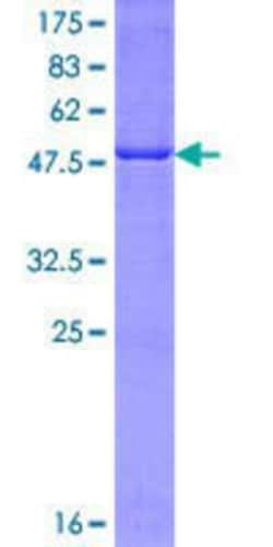 Novus Biologicals Recombinant Human LRAT GST (N-Term) Protein 10 &mu;g | Buy Online | Novus Biologicals&trade; | Fisher Scientific